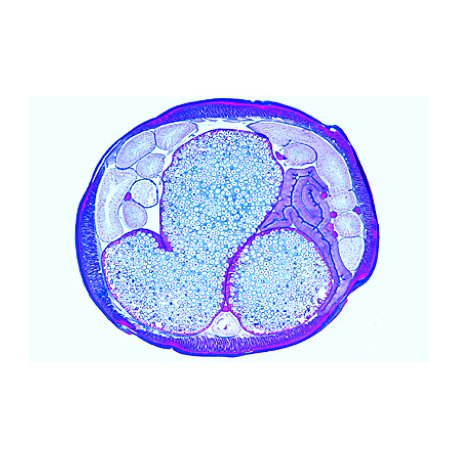 Embryologie Ascaris megalocephala