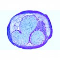 Embryologie Ascaris megalocephala