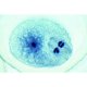 Embryologie Ascaris megalocephala