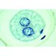 Embryologie Ascaris megalocephala