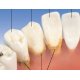 Model zubního onemocnění - 2x zvětšeno - 21 částí