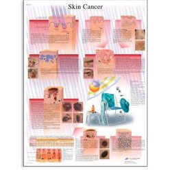 Schéma - rakovina lidské kůže - AJ - 50x67 cm