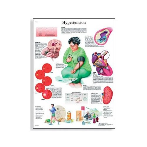 Schéma - hypertenze - AJ - 50x67 cm