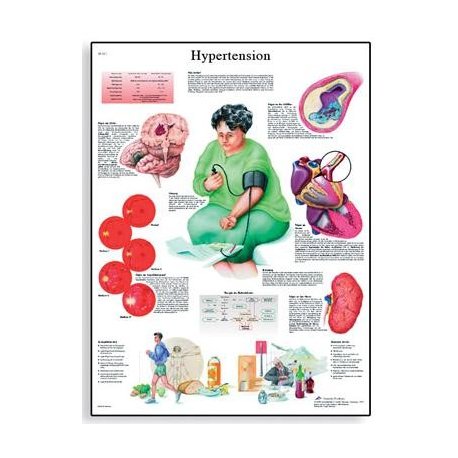 Schéma - hypertenze - AJ - 50x67 cm