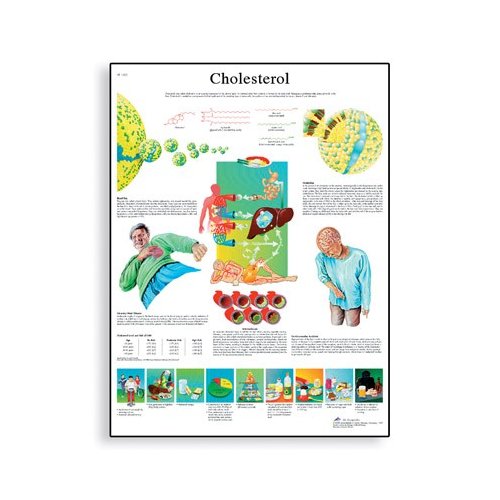 Schéma - cholesterol - AJ - 50x67 cm
