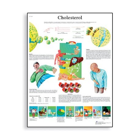 Schéma - cholesterol - AJ - 50x67 cm