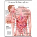 Schéma - nemoci lidské trávící soustavy - AJ - 50x67 cm