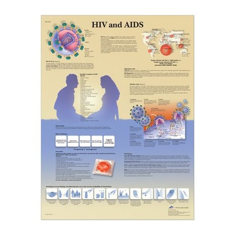 Schéma - HIV virus a AIDS - AJ - 50x67 cm