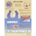 Schéma - HIV virus a AIDS - AJ - 50x67 cm