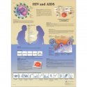 Schéma - HIV virus a AIDS - AJ - 50x67 cm