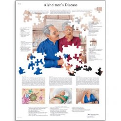 Schéma - Alzheimerova nemoc - AJ - 50x67 cm