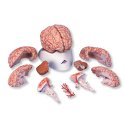 Model lidského mozku s tepnami - 9 částí