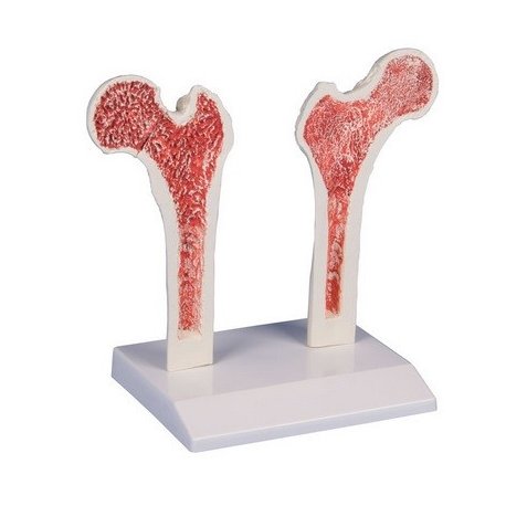 Model osteoporózy - stehenní kost