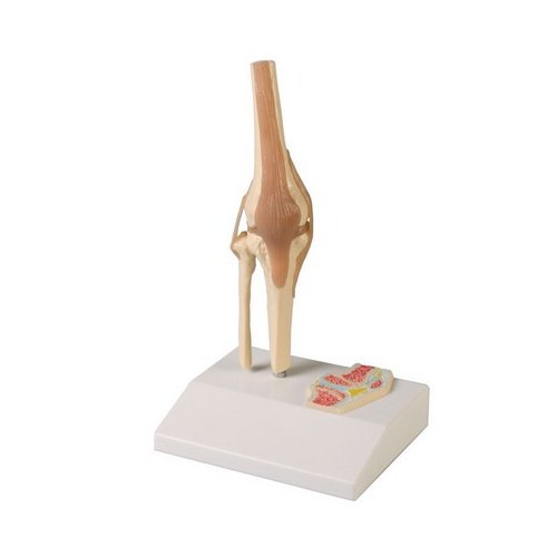 Mini model kolenního kloubu s řezem
