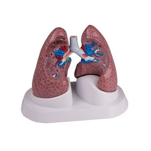 Model onemocnění plic - DOPRODEJ