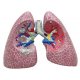 Model onemocnění plic