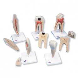 Série modelů lidských zubů - 5 modelů