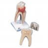 Model lidského zubu ukazuje horní stoličku chrupu dospělého jedince. Zub se skládá ze tří částí a má tři kořeny. Model je uložen na podstavci. Replika stoličky představuje efektivní výukovou pomůcku pro hodiny biologie a pro studenty zubního lékařství. 