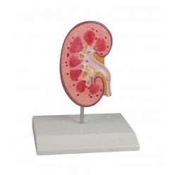 Model ledviny s ledvinovým kamenem