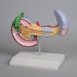 Model onemocnění slinivky, žlučníku a sleziny
