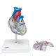 Model srdce s přívodním systémem - 2 části