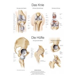 Schéma - anatomie lidské pánve a kolene