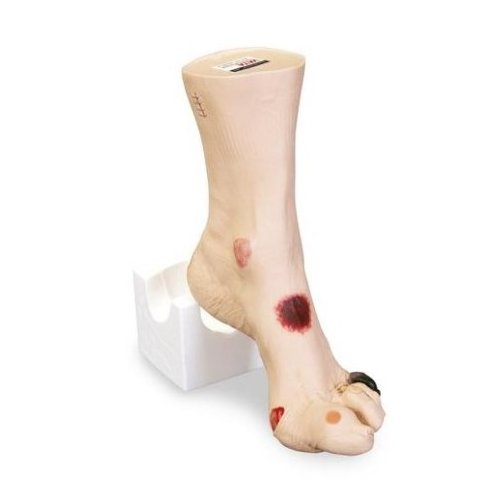 Model zraněné nohy