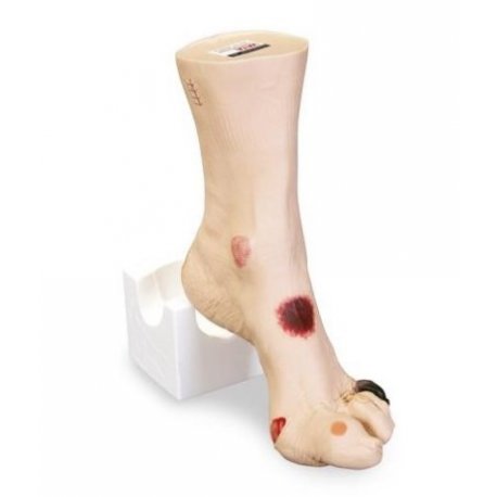 Model zraněné nohy