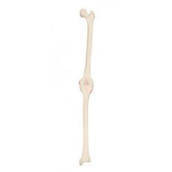Model lidského kolenního kloubu - pravý - ORTHObones - DOPRODEJ