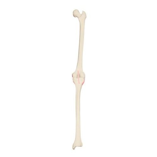 Model lidského kolenního kloubu - pravý - ORTHObones - DOPRODEJ