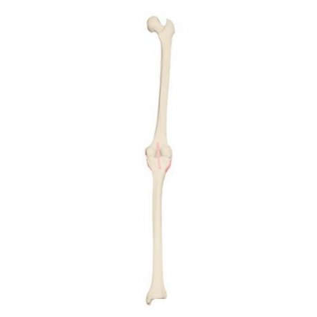 Model lidského kolenního kloubu - pravý - ORTHObones