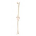 Model lidského kolenního kloubu - pravý - ORTHObones - DOPRODEJ