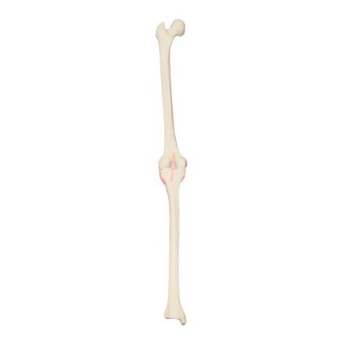 Model lidského kolenního kloubu - levý - ORTHObones - DOPRODEJ