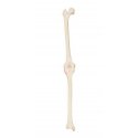 Model lidského kolenního kloubu - levý - ORTHObones - DOPRODEJ