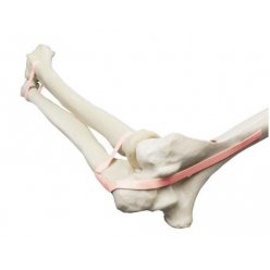 Model lidského loketního kloubu - ORTHObones - DOPRODEJ