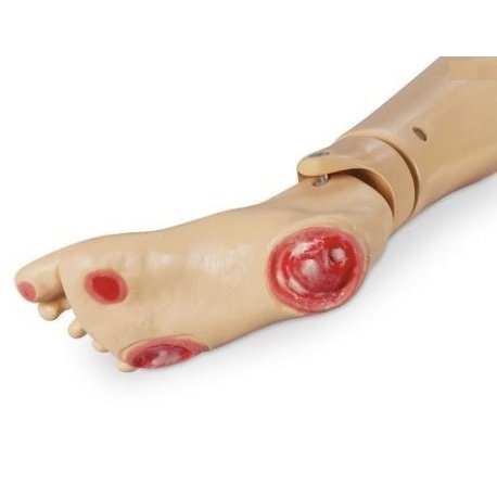 Model nemocné nohy - dekubity