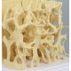 Model kostní tkáně osteoporotické kosti