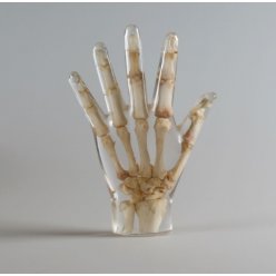 Model lidské ruky pro RTG vyšetření, průhledný