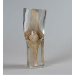 Model lidského kolene pro RTG vyšetření, průhledný
