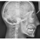RTG snímek modelu lidské hlavy s krčními obratli