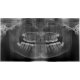RTG snímek zubů modelu lidské hlavy s krčními obratli
