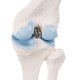 Mini model lidského kolenního kloubu - příčný řez