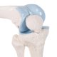 Model lidského kolenního kloubu mini - příčný řez