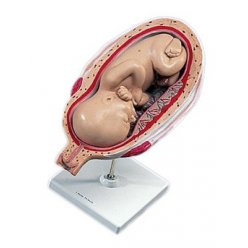 Plod v sedmém měsíci těhotenství