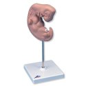 Lidské embryo - 25x zvětšené