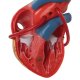 Model srdce člověka s bypassem - 2 části