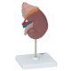 Model ledviny člověka s nadledvinou