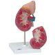 PŮJČOVNA Model lidské ledviny s nadledvinou - 2 části