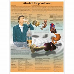 Schéma - závislost na alkoholu - AJ - 50x67 cm