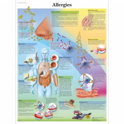 Schéma - alergie - AJ - 50x67 cm - DOPRODEJ